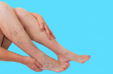 Everyday Habits That Improve Vein Health and Reduce Discomfort